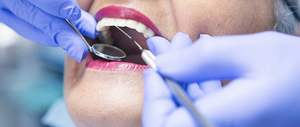 Best Emergency Treatment for Dental Infections or Abscesses in Patterson Tract, CA