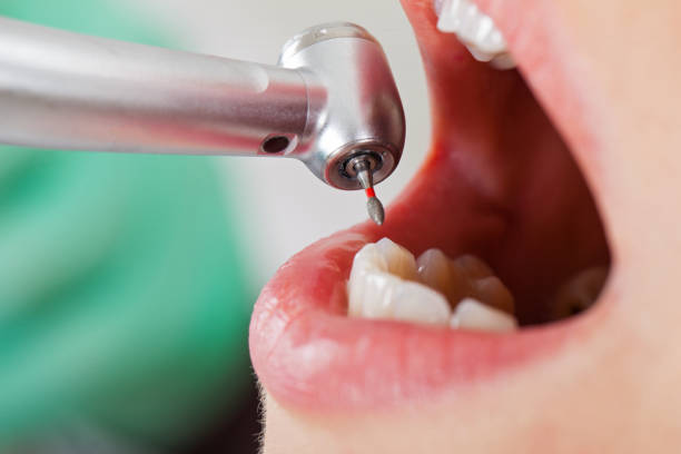Best Same-Day Emergency Dental Services in Patterson Tract, CA